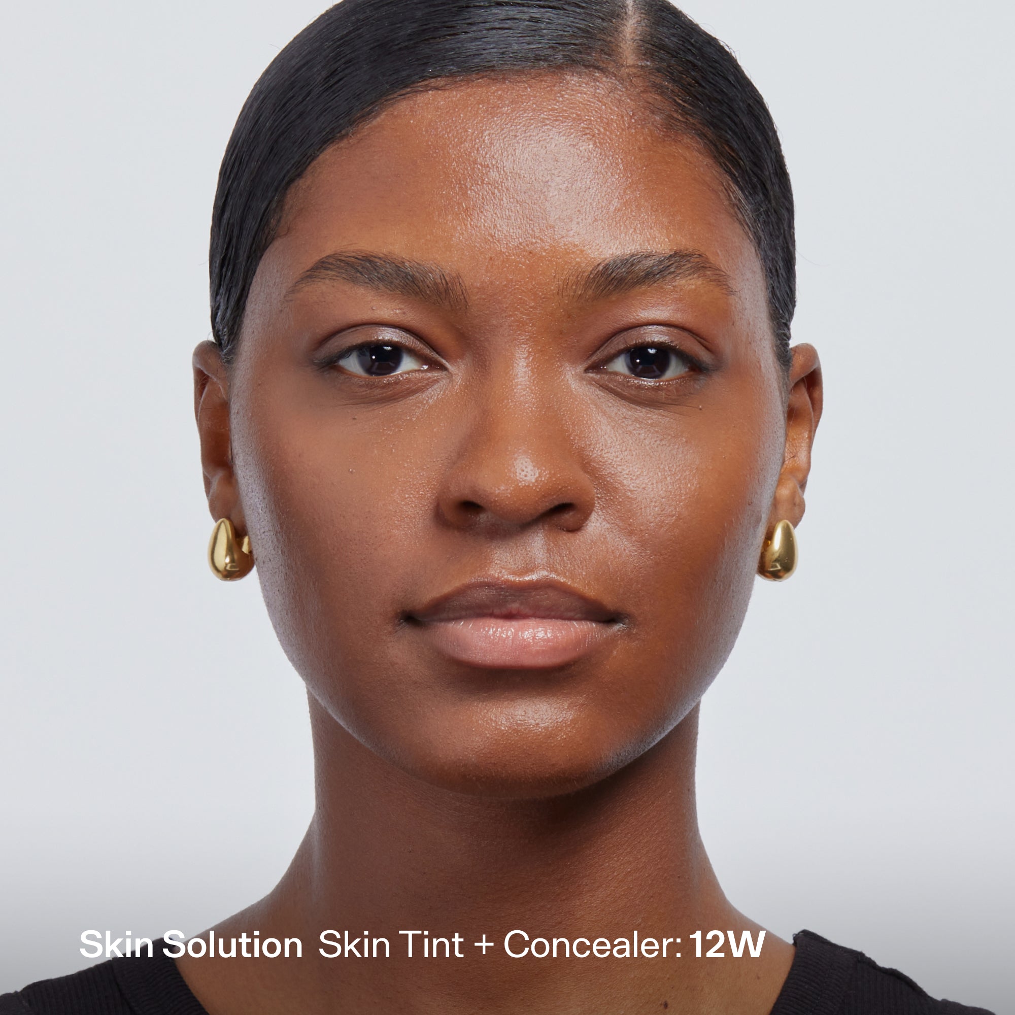Skin Solution - Image 170