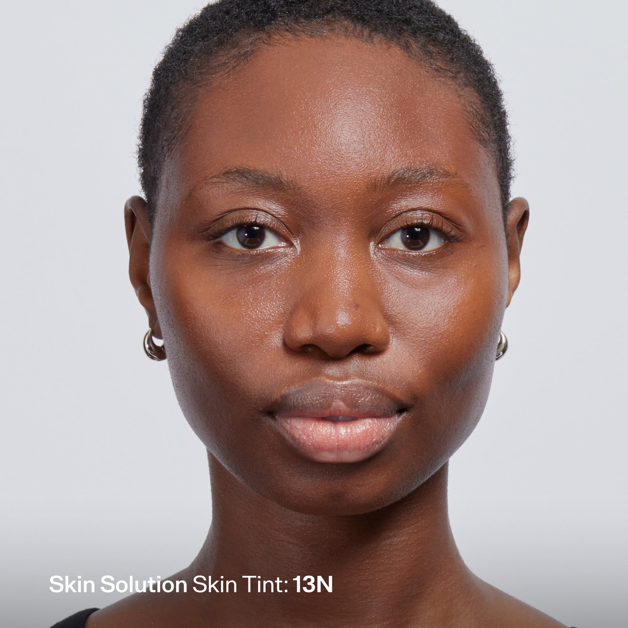Skin Solution - Image 184