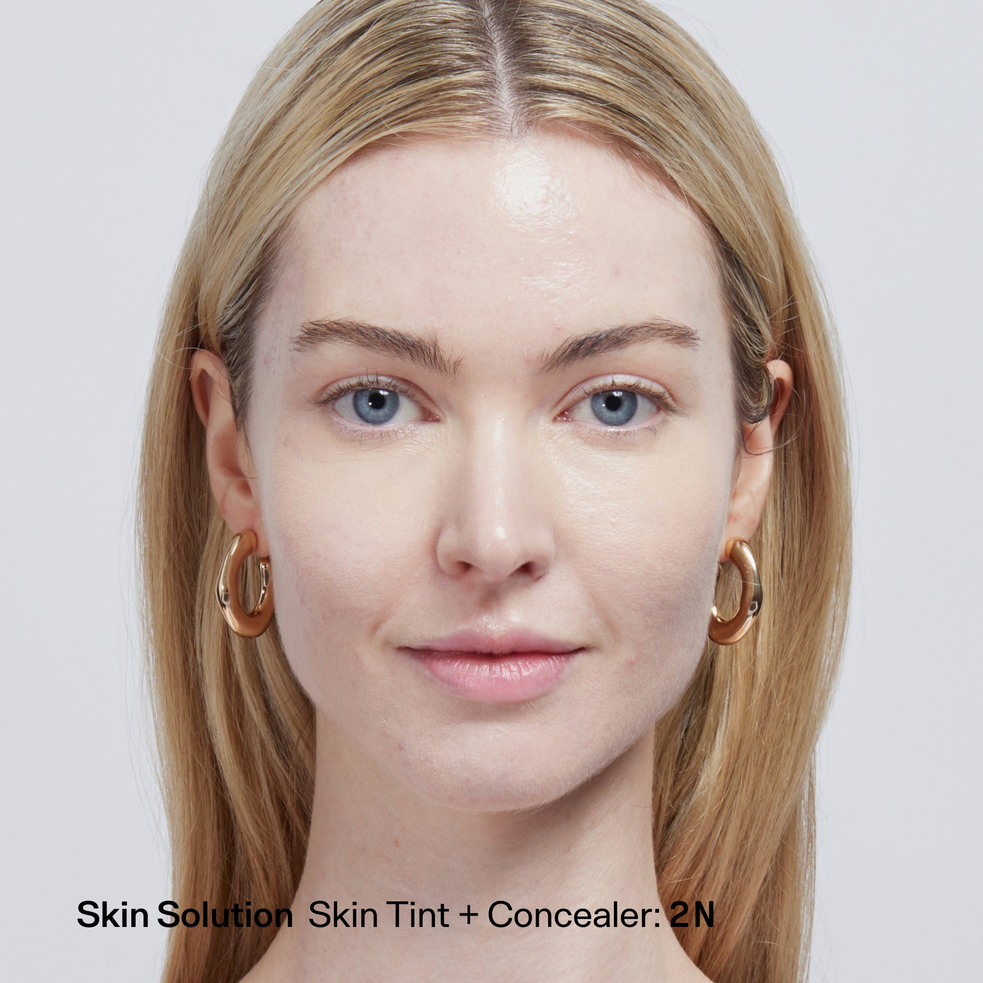 Skin Solution - Image 20