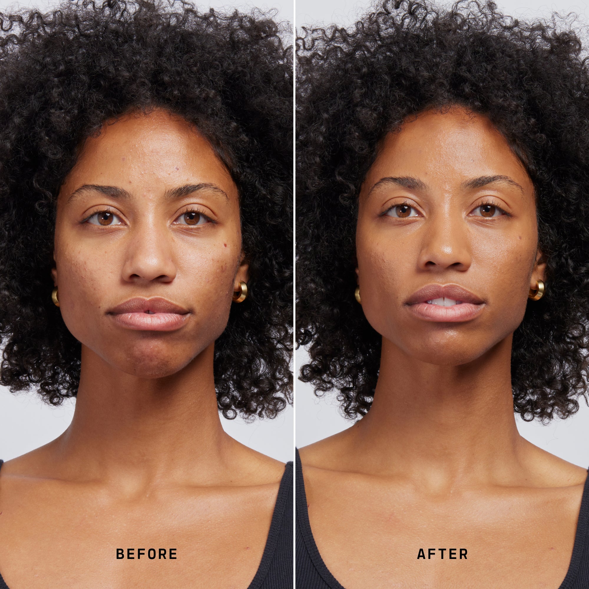 Skin Solution - Image 138
