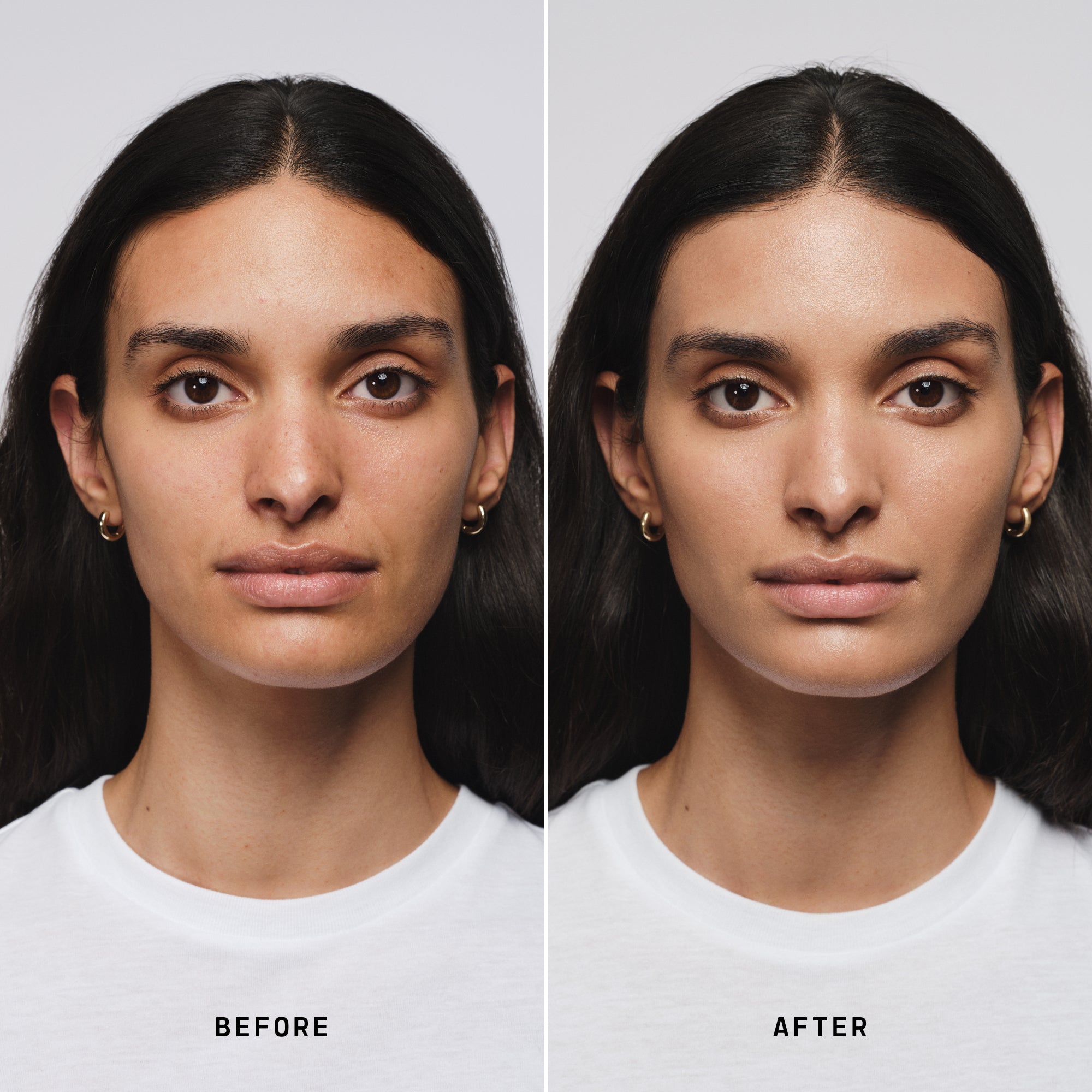 Skin Solution - Image 93